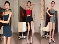 Viral! Wanita Ini Punya Berat Badan 25 Kg, tapi Masih Ingin Kurus Lagi